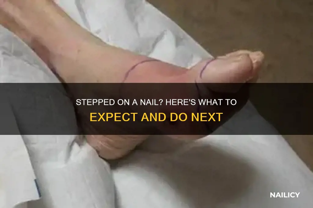 what to expect after stepping on a nail