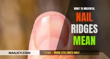 Horizontal Nail Ridges: What Your Nails Are Trying to Tell You