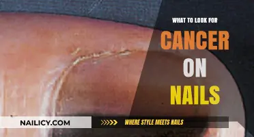 Spotting Cancer Signs: Key Nail Changes to Watch For