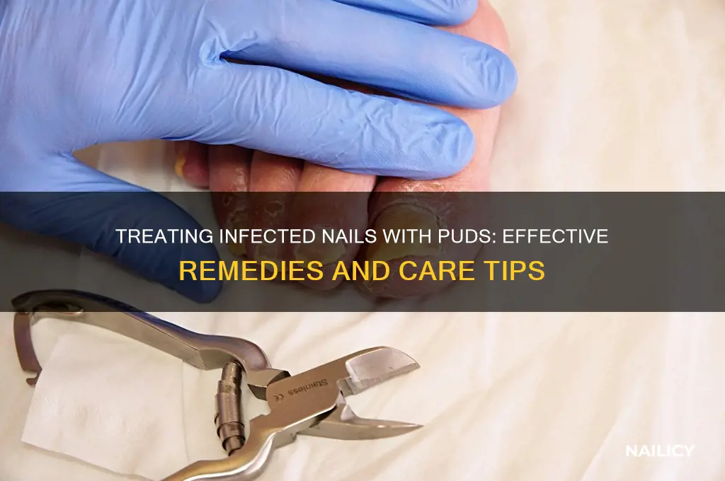 what to pit on infected nail with puds