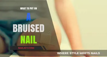 Healing Bruised Nails: Effective Remedies and Care Tips for Quick Recovery