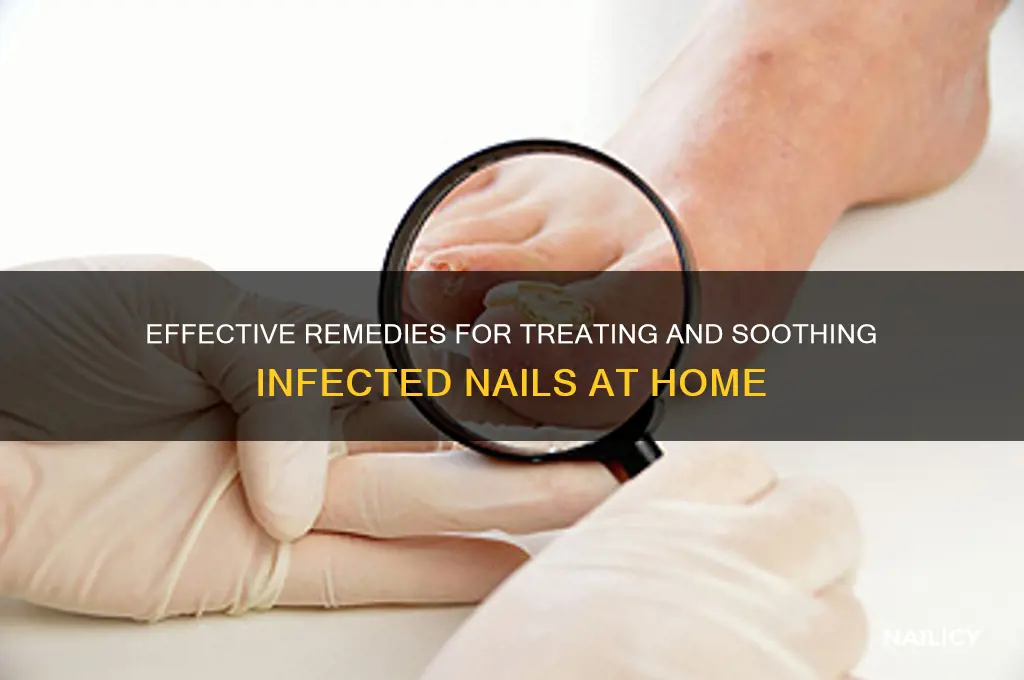 what to put on an infected nail