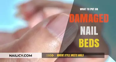 Heal and Restore: Best Remedies for Damaged Nail Beds