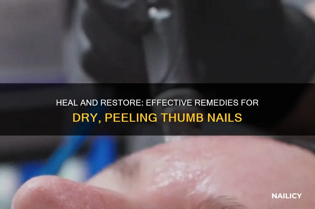 what to put on dry peeling thumb nail