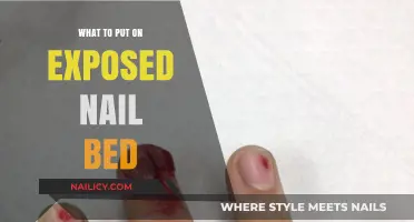 Healing Exposed Nail Beds: Effective Remedies and Care Tips
