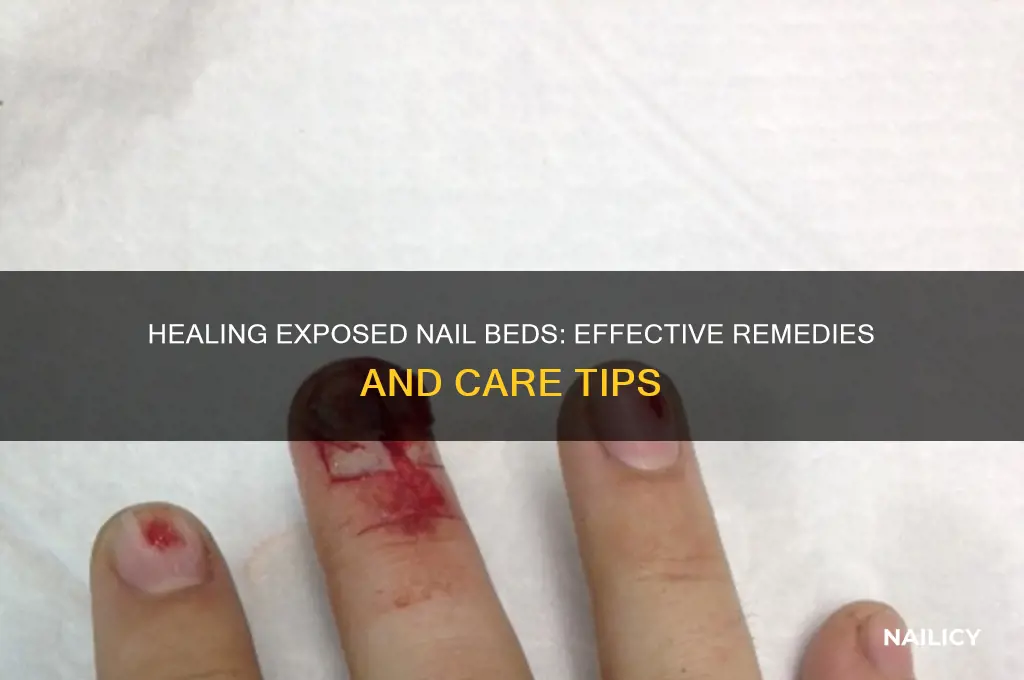 what to put on exposed nail bed