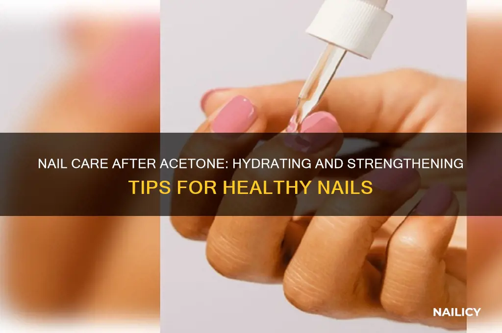 what to put on nails after acetone