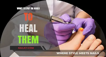 Nail Healing Essentials: Top Treatments for Stronger, Healthier Nails