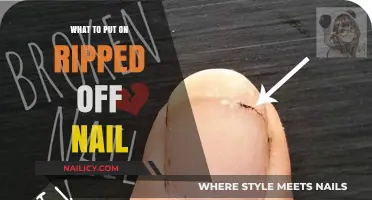 Quick Fixes for Ripped Nails: Simple Solutions for Instant Relief
