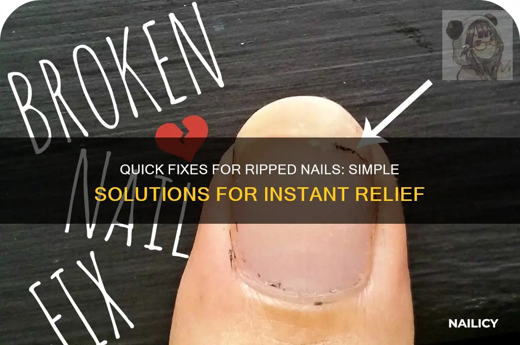 what to put on ripped off nail