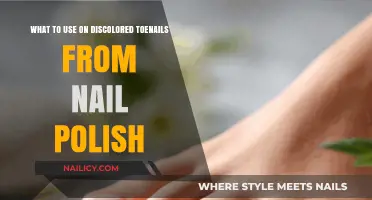 Revive Discolored Toenails: Best Remedies After Nail Polish Wear
