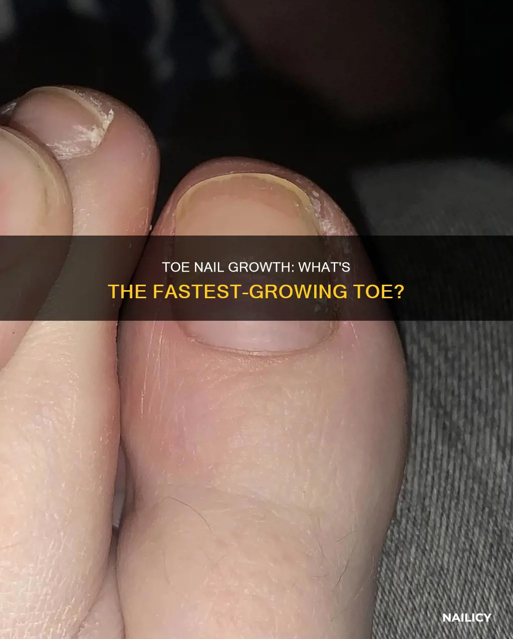 what toe nail grow faster