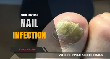 Uncovering Common Causes and Triggers of Nail Infections: A Comprehensive Guide
