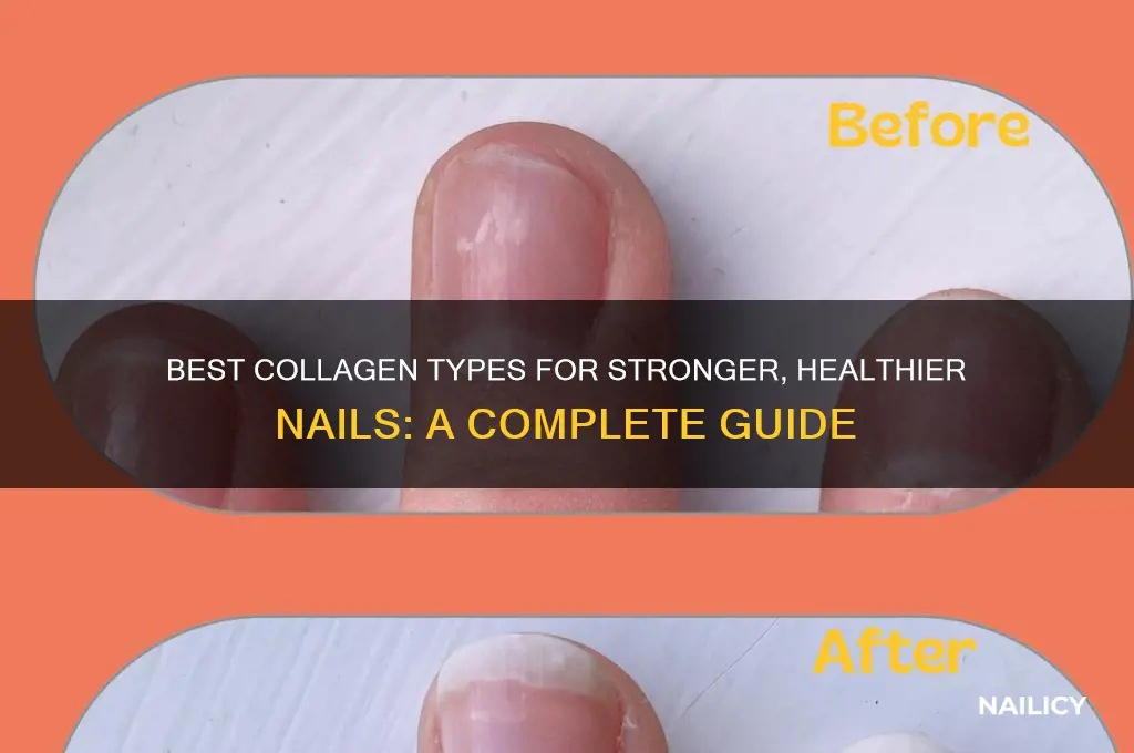 what type of collagen is best for nails