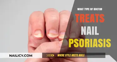 Which Specialist Treats Nail Psoriasis? A Comprehensive Guide for Patients
