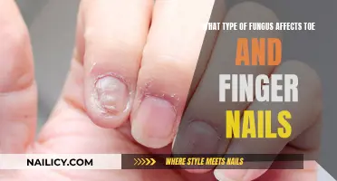 Fungal Infections: Affecting Your Nails and How to Treat Them
