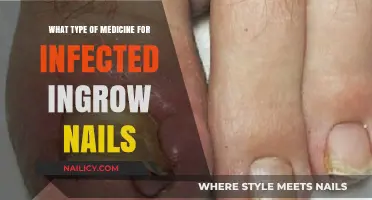 Effective Treatments for Infected Ingrown Toenails: Medication Options Explained