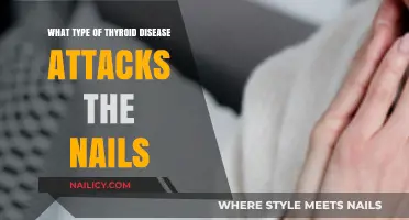 Thyroid Disease and Nail Health: Uncovering the Connection and Symptoms
