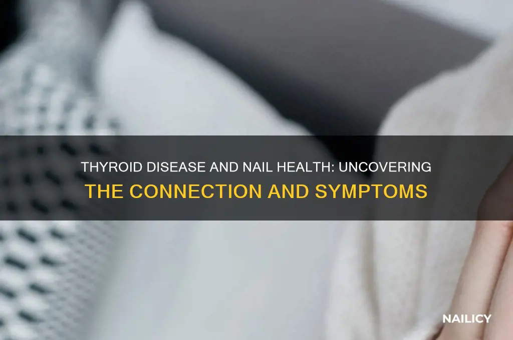 what type of thyroid disease attacks the nails