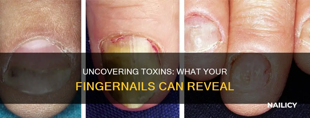 what type of toxins show up in finger nail