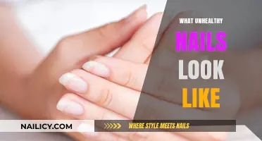 Unhealthy Nails: Signs, Symptoms, and What to Look For