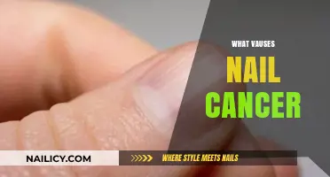 Understanding Nail Cancer: Causes, Risk Factors, and Prevention Tips