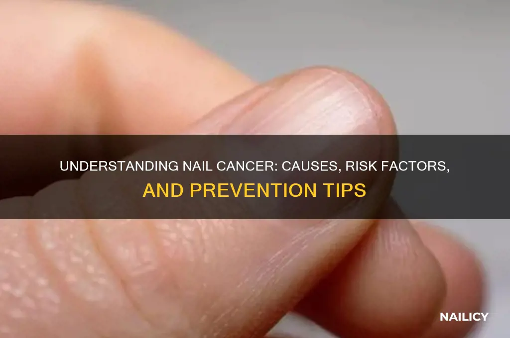 what vauses nail cancer