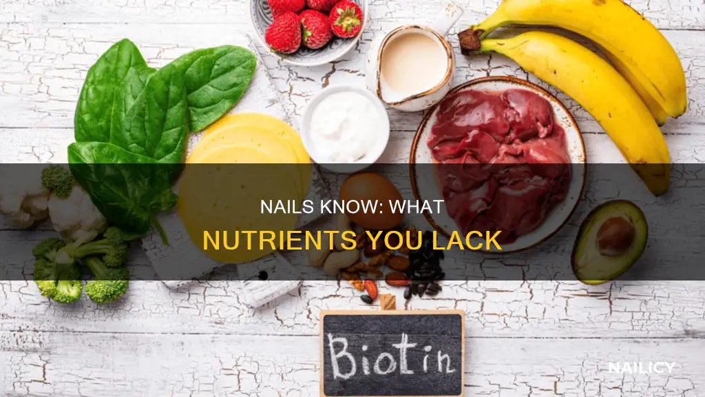 what vitamin am ibmissing if my nails grow under