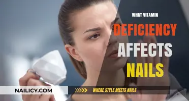 Vitamin Deficiency and Nail Health: Uncovering the Hidden Connection