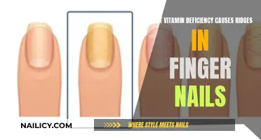 Nutrition and Nails: Ridges and Deficiency