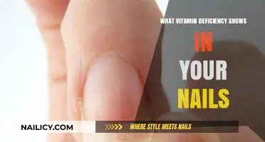 Brittle, Ridged, or Discolored Nails? Uncover Hidden Vitamin Deficiencies
