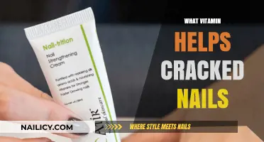 Strengthen Your Nails: Discover the Vitamin That Repairs Cracked Nails