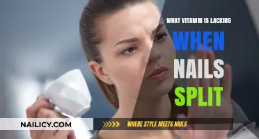 Brittle Nails? Discover the Vitamin Deficiency Causing Your Splits