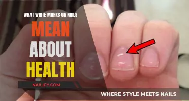 White Marks on Nails: What They Mean for Your Health