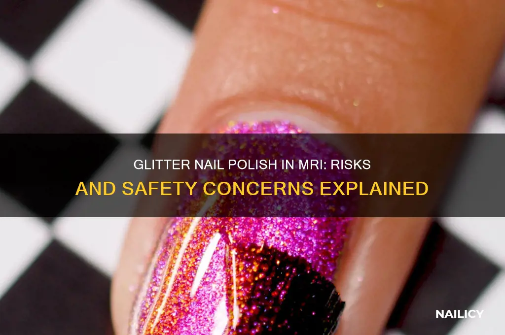 what will happen ifi wear glitter nail polish in mri