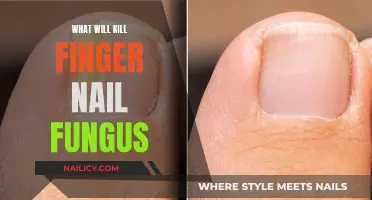 Effective Treatments to Eliminate Stubborn Nail Fungus