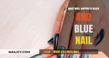 Black and Blue Nails: Causes, Risks, and Treatment Options Explained