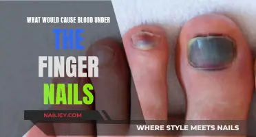 Injured Fingernails: What Could Cause Blood?