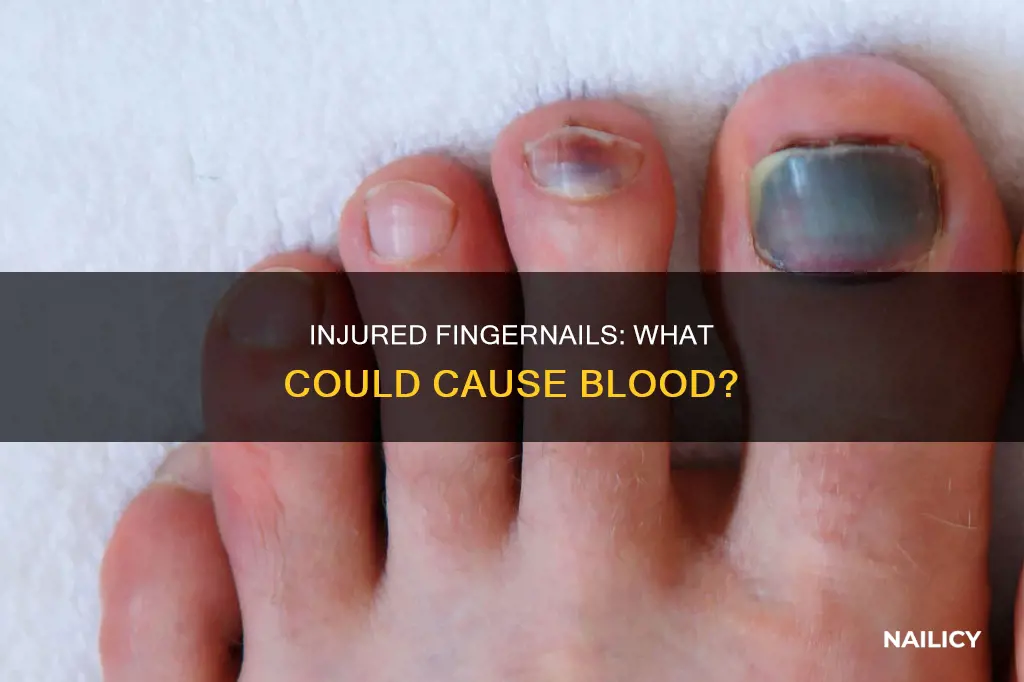 what would cause blood under the finger nails