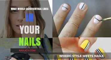 Vertical Nail Lines: Causes and What They Reveal About Your Health