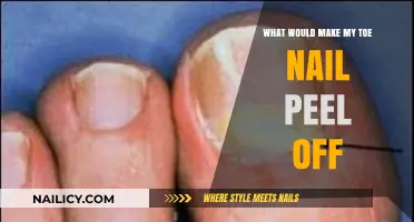 Why Your Toenail is Peeling: Causes, Treatments, and Prevention Tips