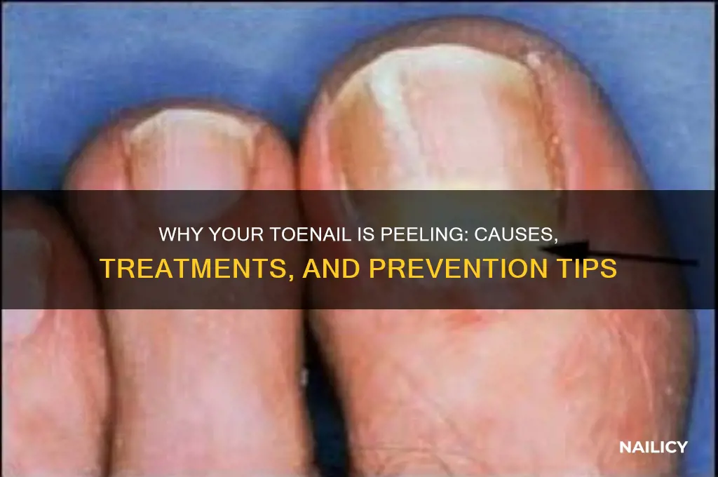 what would make my toe nail peel off