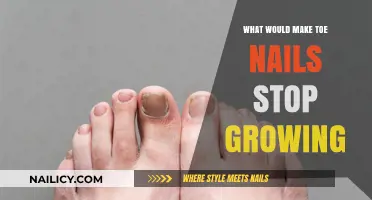 How to Stop Toenail Growth Permanently