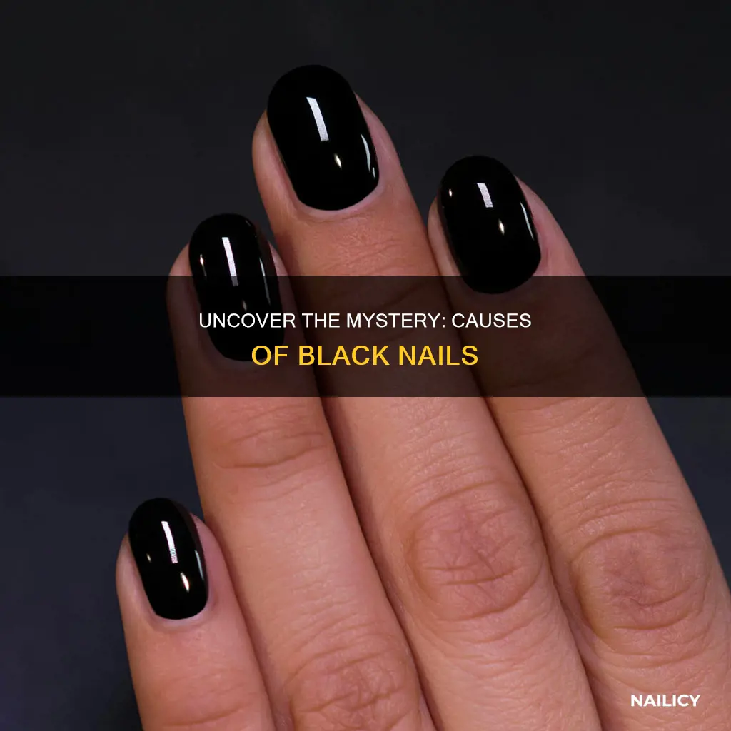 what would make your finger nails black