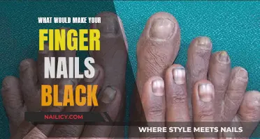 Uncover the Reasons Behind Black Fingernails