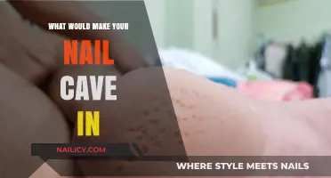 Why Nails Cave In: Causes, Prevention, and Treatment Explained