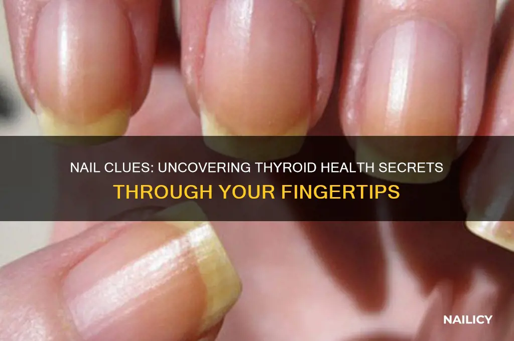 what your nails reveal about your thryoid health