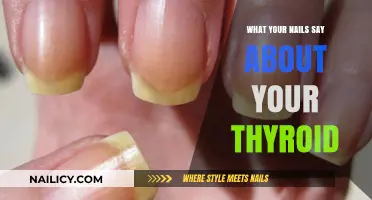 Thyroid Health Clues: What Your Nail Changes Reveal