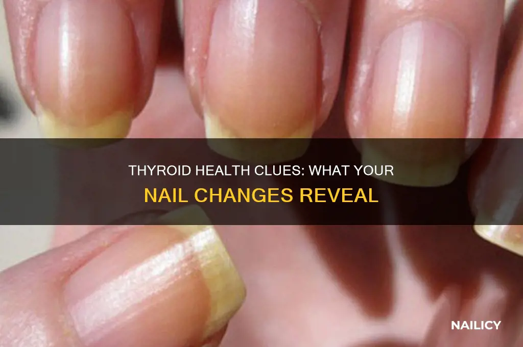 what your nails say about your thyroid