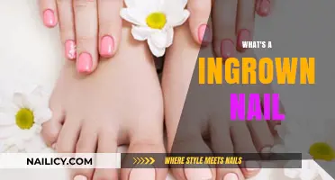 Understanding Ingrown Nails: Causes, Symptoms, and Effective Treatment Options